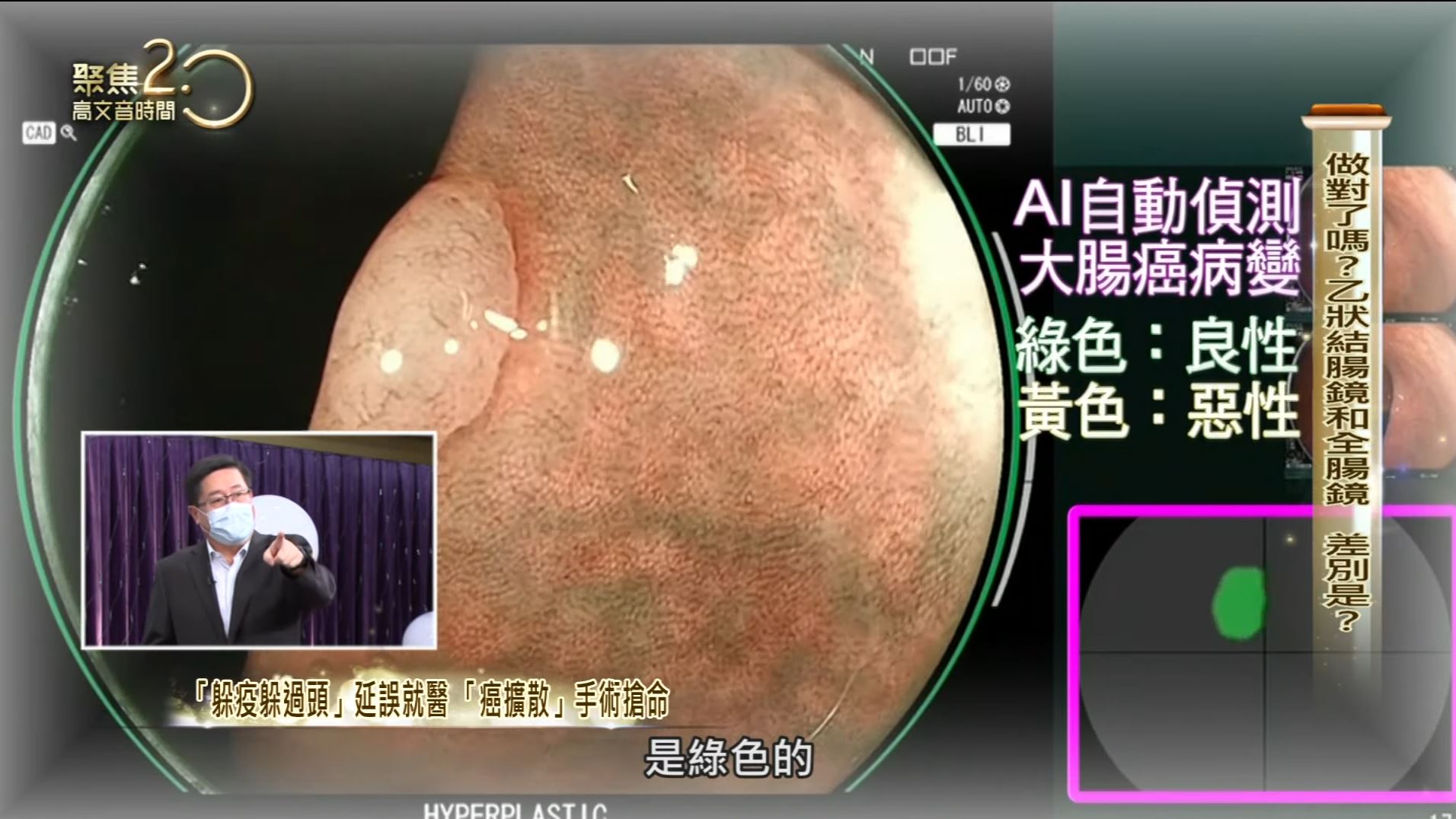 張鳳書父年年做大腸鏡無法揪癌 原因竟是？【聚焦2.0】第401集