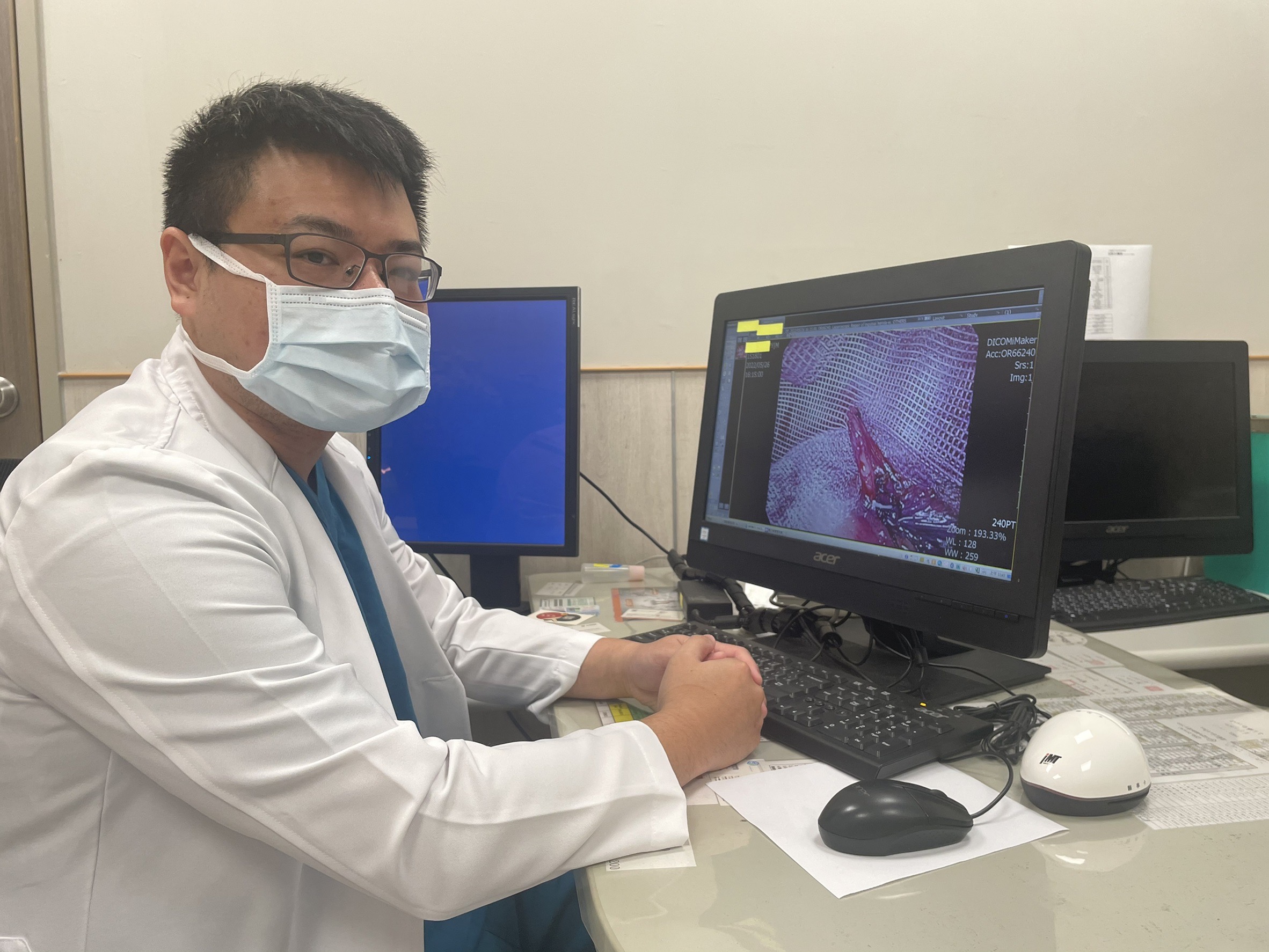 運動教練下腹部疼痛一個月 疝氣年輕化