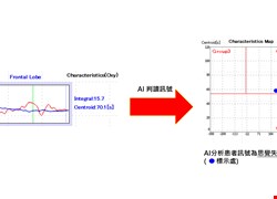 腦功能檢查合併新創AI技術　協助醫師精準評估憂鬱症