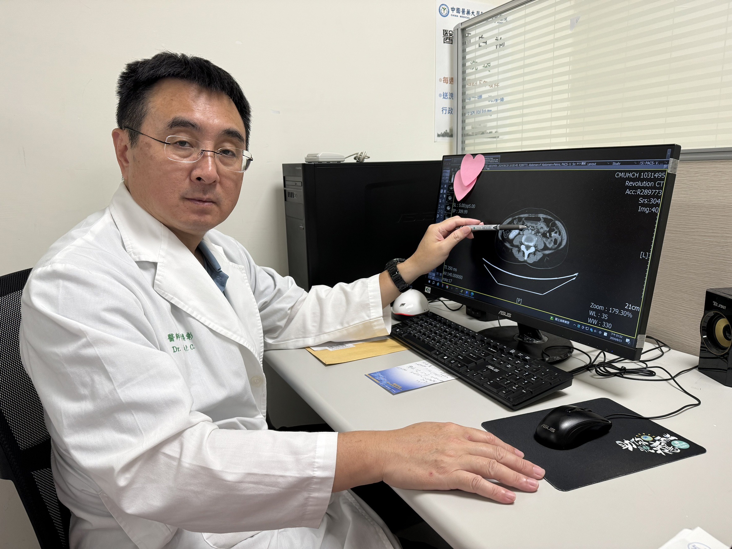 無症狀竟是胃癌第二期 達文西手術切除