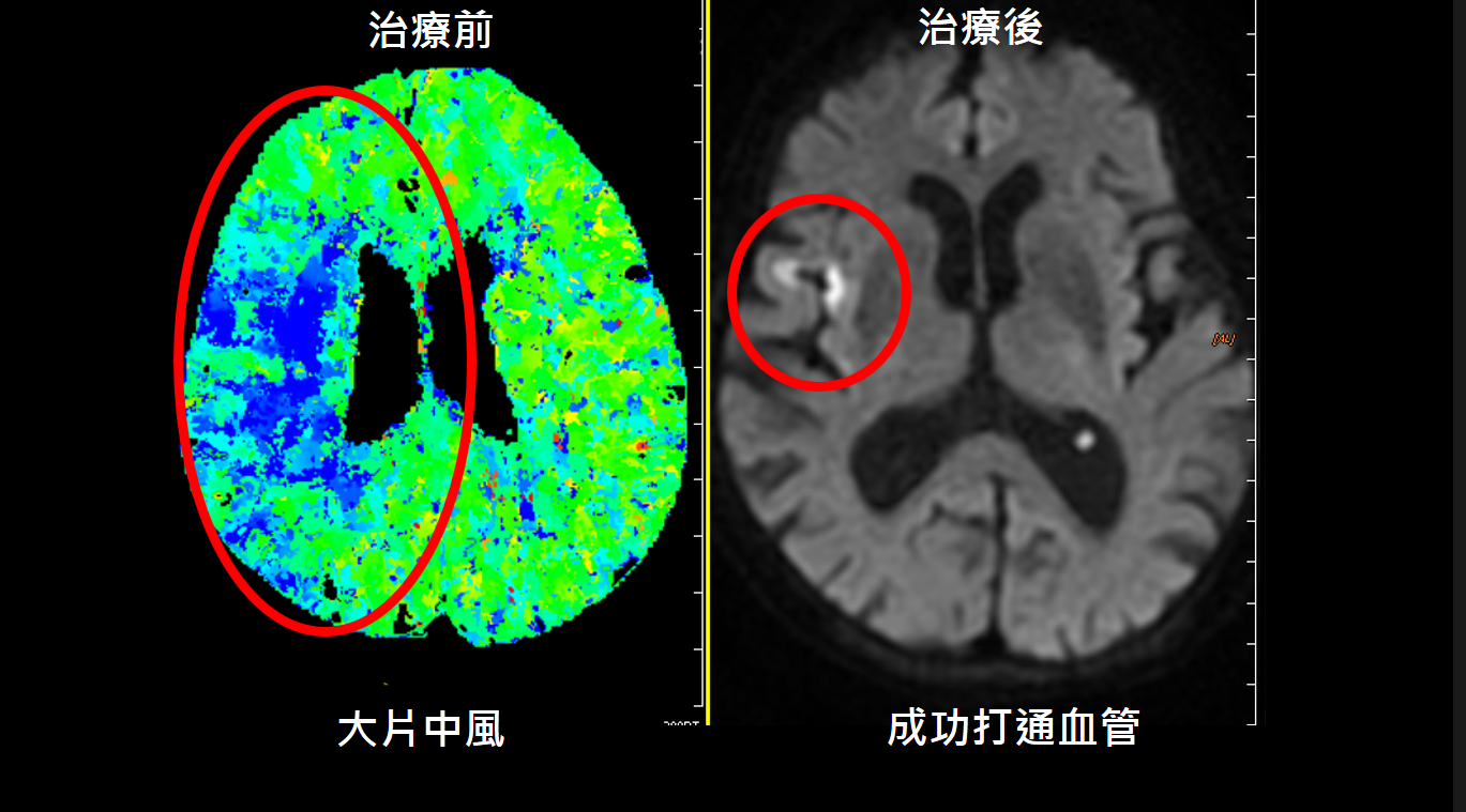 治療前後比較