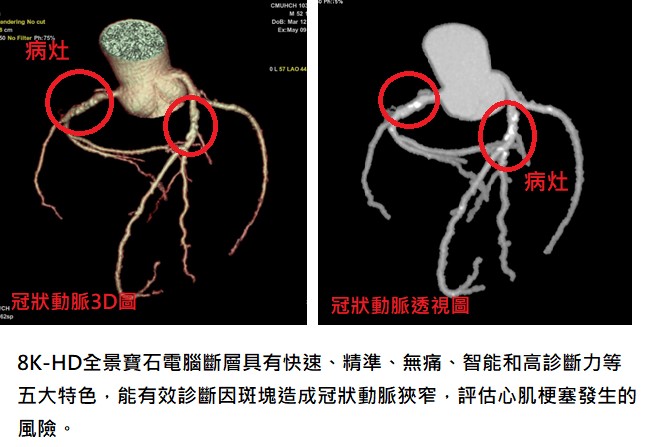 醫療影像