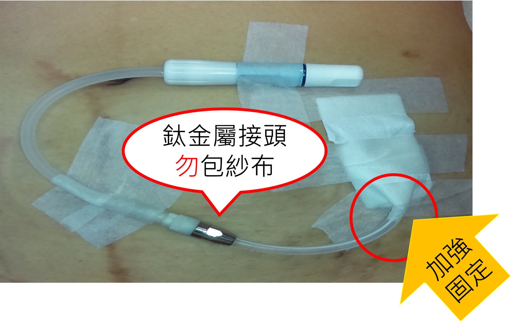 示範圖片