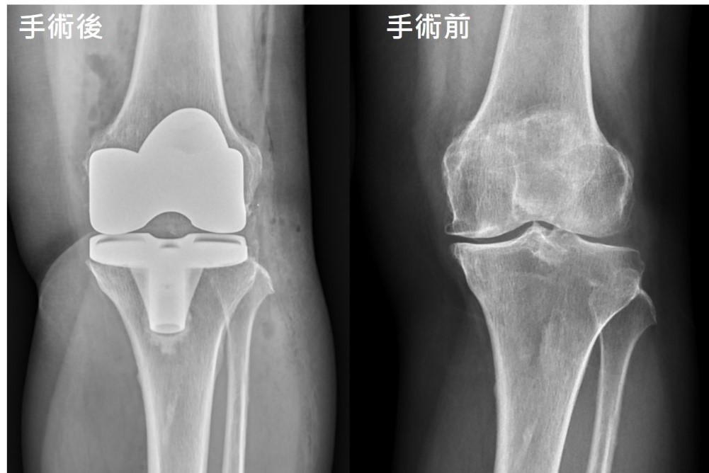 示範圖片、新聞畫面擷取等