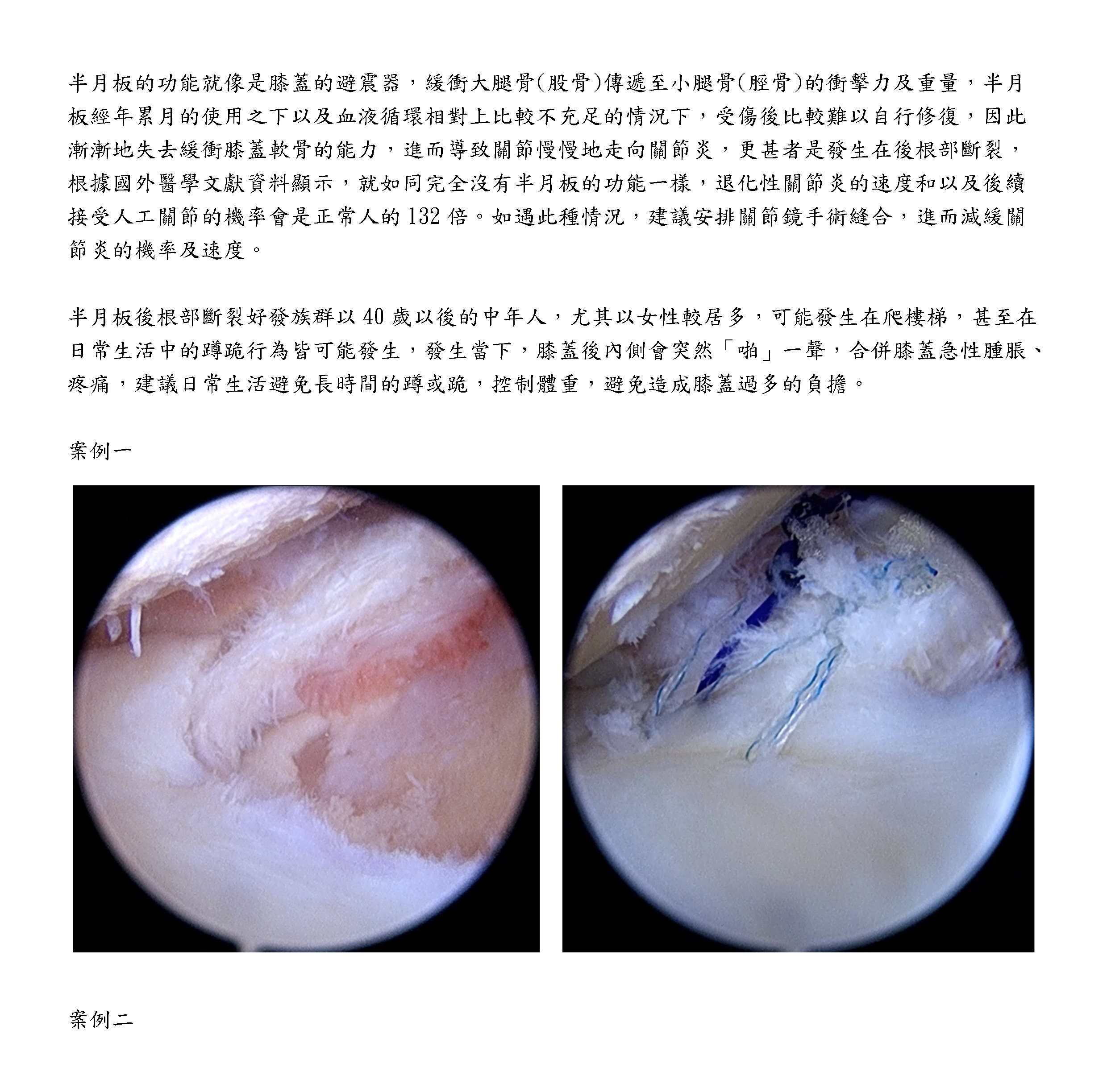 示範圖片、新聞畫面擷取等