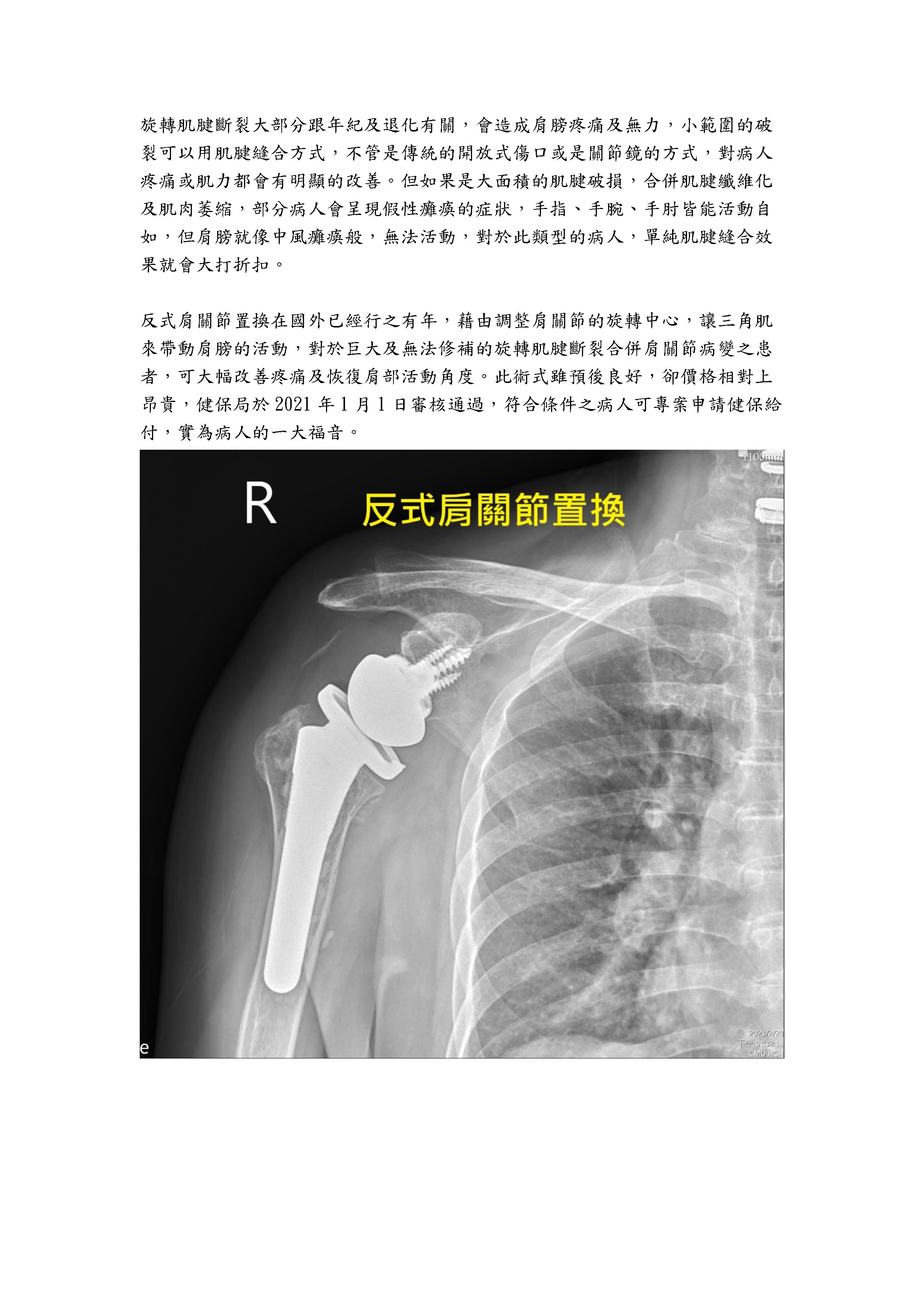 示範圖片、新聞畫面擷取等