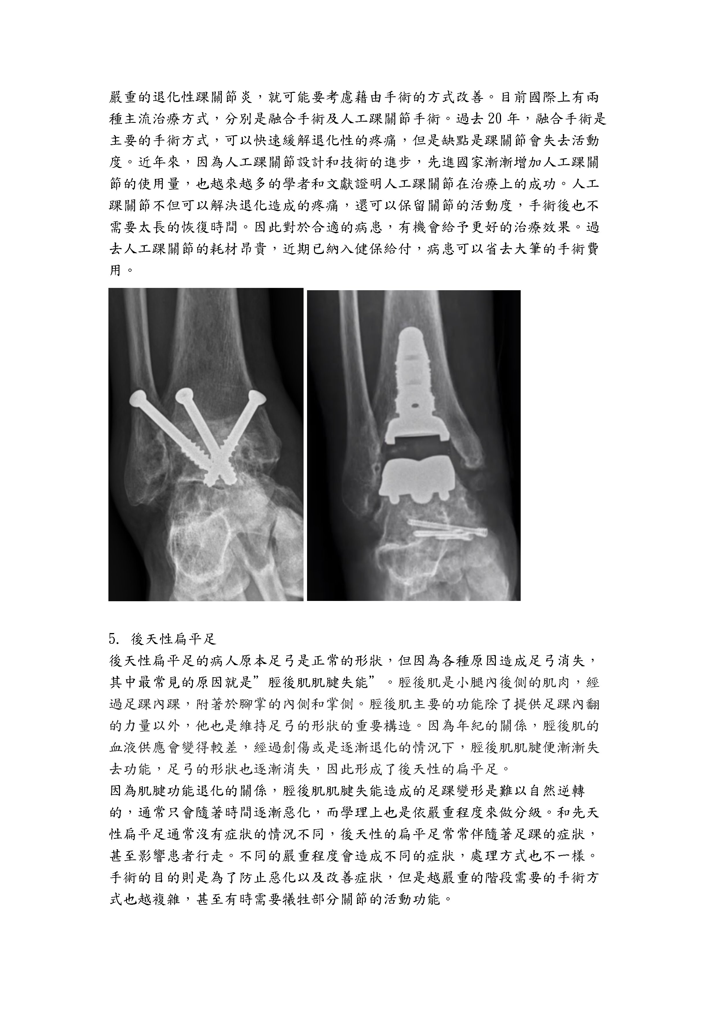 示範圖片、新聞畫面擷取等